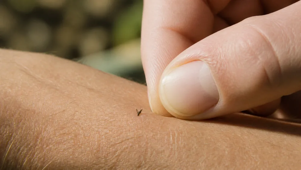 Extreme close view of a thumbnail flicking a small dark honeybee sting off the skin of a forearm - removing a sting in the first second | KnowOutdoor