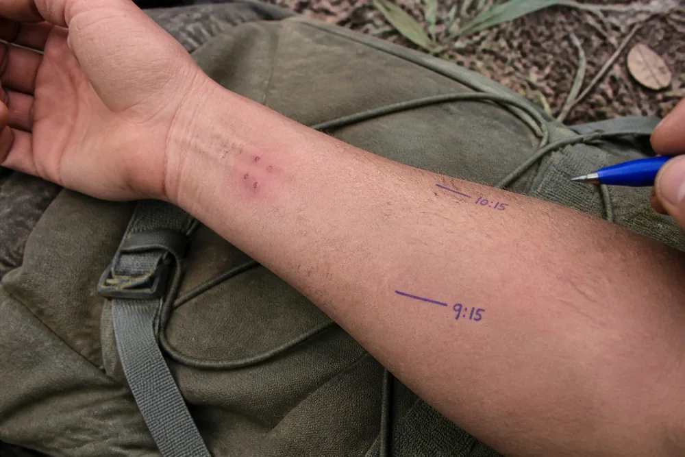 A forearm with two puncture marks and modest swelling, marked with two ballpoint lines at successive swelling edges with times written beside each - the timed progression record a hospital cannot reconstruct later | KnowOutdoor